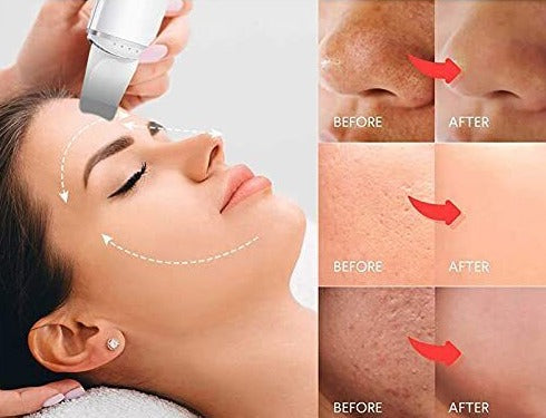 Épurateur électronique de peau pour le visage